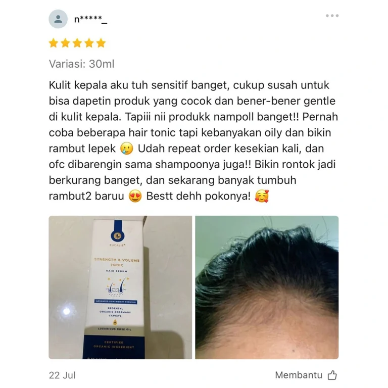 Review Shopee - kulit kepala sensitif, rambut baru tumbuh